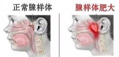 武汉民生耳鼻喉医院专业医院给您带来健康保障以人为本正规诊疗